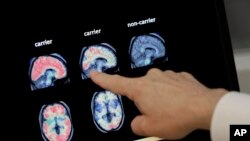 Alzheimer Drug